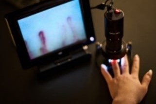 血流観察で体のめぐりを可視化 血流観察による毛細血管の状態確認